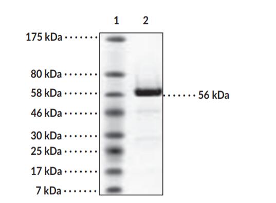 Lane 1: MW Markers; Lane 2: HDAC2 (7 μg). Representative gel image shown; actual purity may vary between each batch.
